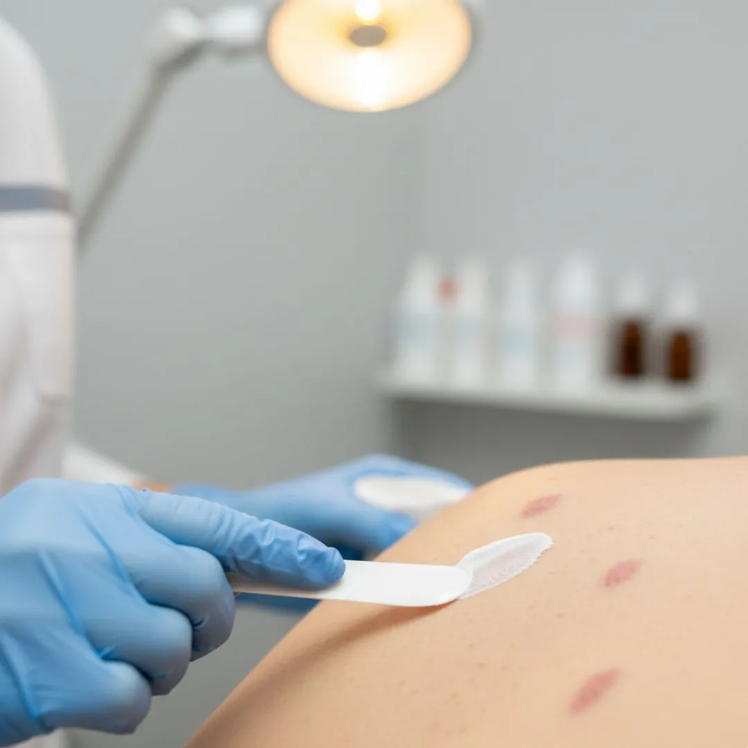 Immune Response Modifier Immune Response Modifier