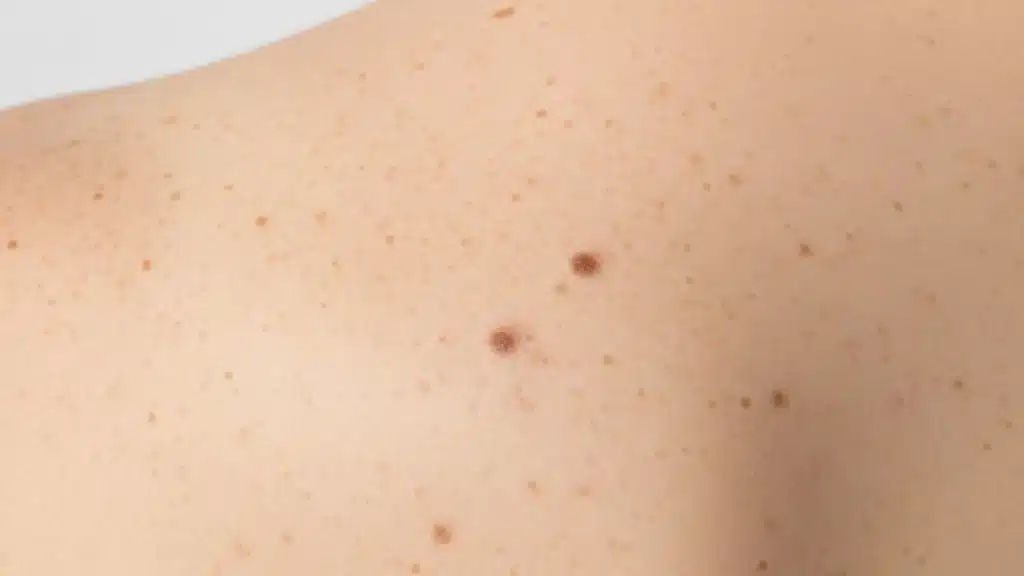 High UV exposure in Canberra throughout the year despite mild climate