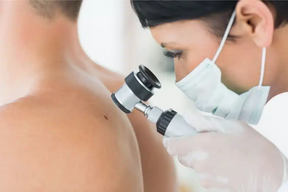 mole check clinic