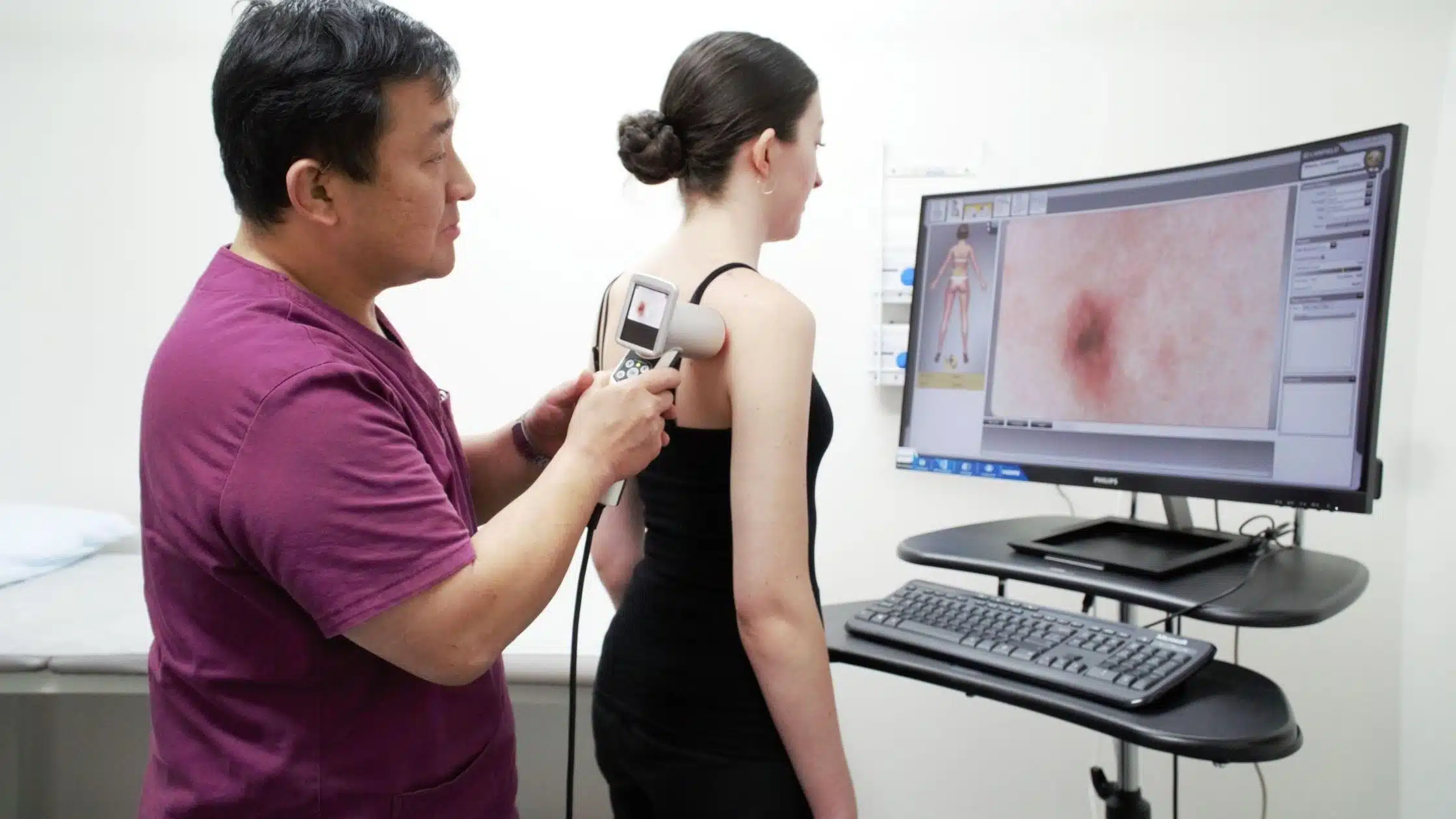 full body skin cancer check