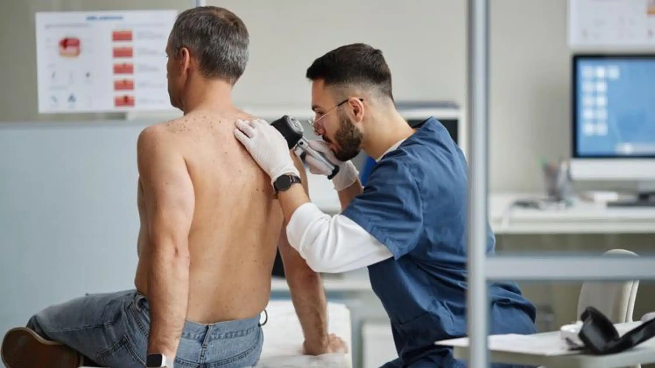 Full Body Skin Cancer Check