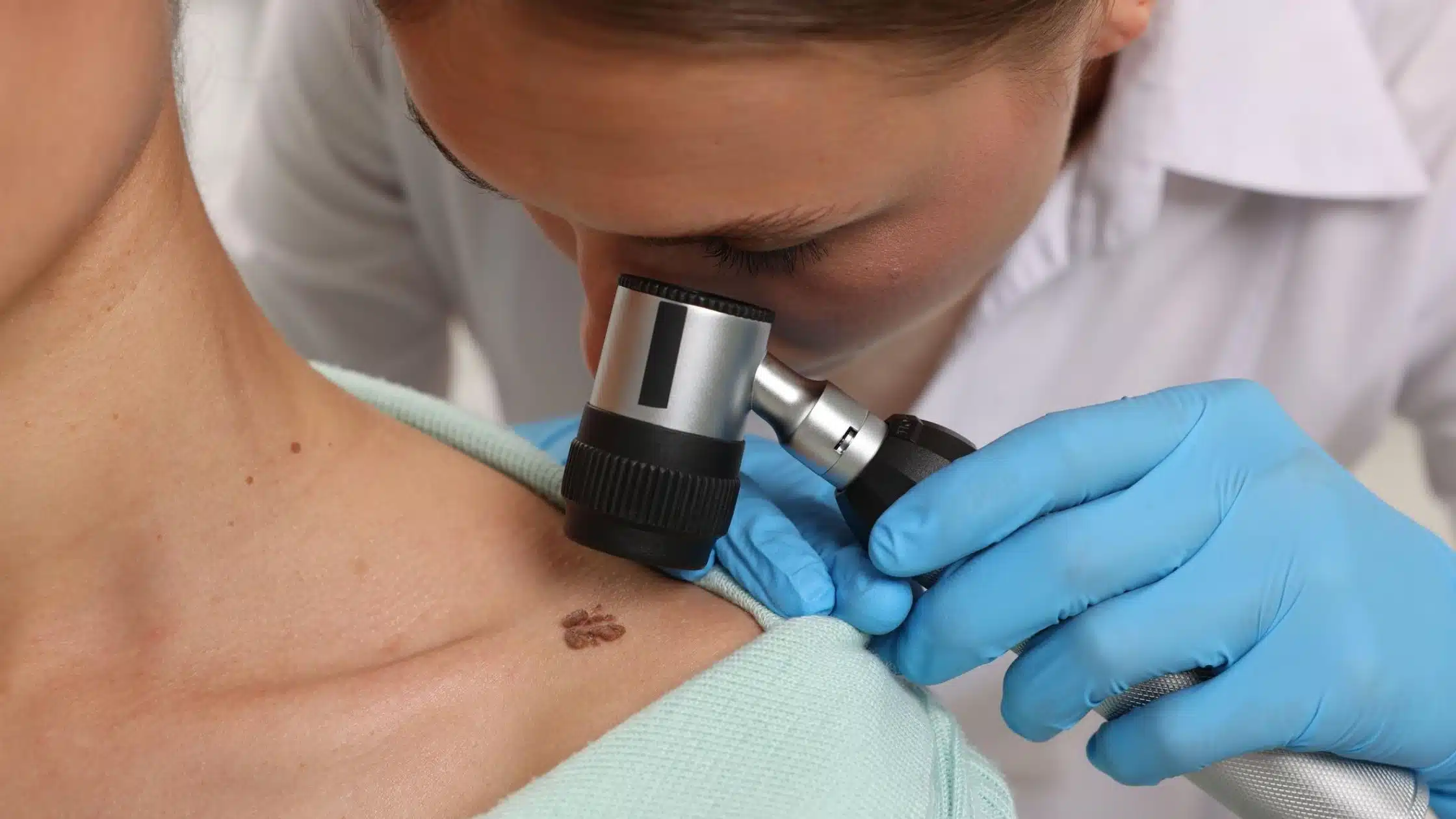Skin Cancer Warning Signs in Canberra