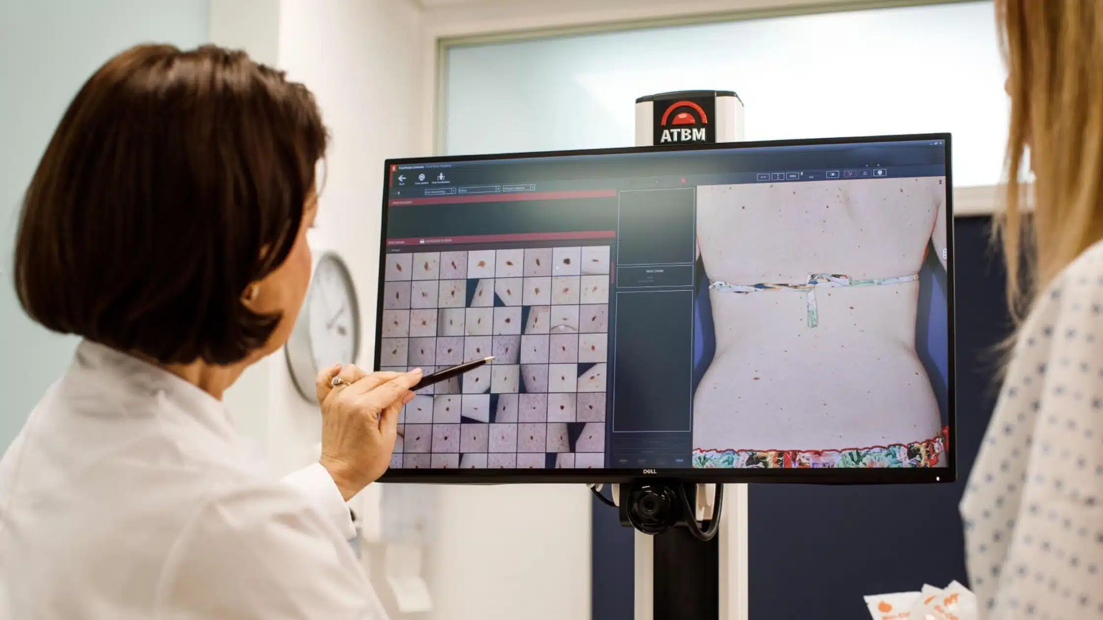 Digital Mole Mapping in Canberra